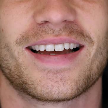 Slider image (10) Dentech Dental Centar